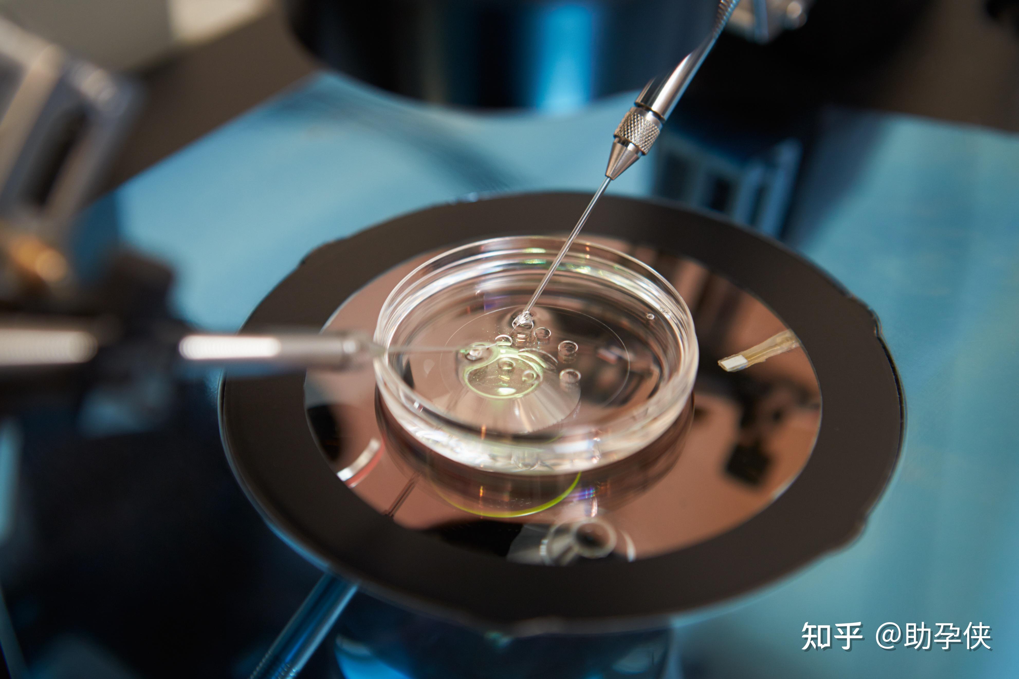 试管婴儿最大寿命 试管婴儿能活多少年寿命